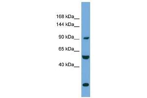 Western Blot showing EXOC1 antibody used at a concentration of 1-2 ug/ml to detect its target protein.