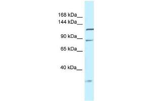 Western Blot showing Tmem132d antibody used at a concentration of 1. (TMEM132D 抗体  (Middle Region))