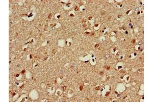 Immunohistochemistry of paraffin-embedded human brain tissue using ABIN7155835 at dilution of 1:100 (OTX1 抗体  (AA 29-244))