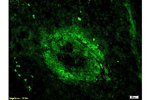 Formalin-fixed and paraffin embedded mouse lymphoma tissue labeled Anti-CD3 Polyclonal Antibody, Unconjugated (ABIN672921) 1:200, followed by conjugation to the secondary antibody Goat Anti-Rabbit IgG, FITC conjugated used at 1:200 dilution for 40 minutes at 37°C. (CD3 epsilon 抗体  (AA 101-189))