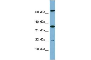 WB Suggested Anti-RWDD1 Antibody Titration: 0. (RWDD1 抗体  (Middle Region))