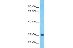 Host:  Rabbit  Target Name:  MDFI  Sample Type:  RPMI-8226 Whole Cell lysates  Antibody Dilution:  1. (MDFI 抗体  (Middle Region))