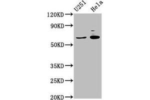 Western Blot Positive WB detected in: U251 whole cell lysate, Hela whole cell lysate All lanes: GABRA4 antibody at 7 μg/mL Secondary Goat polyclonal to rabbit IgG at 1/50000 dilution Predicted band size: 62 kDa Observed band size: 62 kDa (GABRA4 抗体  (AA 36-258))