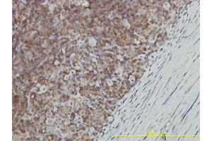 Immunostaining (ISt) image for anti-Galactose-1-Phosphate Uridylyltransferase (GALT) (AA 1-379) antibody (ABIN560995)