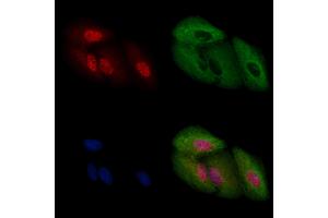 ABIN6257407 and ABIN6274203 staining  cells by IF/ICC.