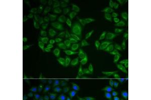 Immunofluorescence analysis of A549 cells using CD247 Polyclonal Antibody (CD247 抗体)