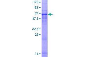 Image no. 1 for Regulator of Chromosome Condensation (RCC1) and BTB (POZ) Domain Containing Protein 1 (RCBTB1) (AA 1-355) protein (GST tag) (ABIN1317682) (RCBTB1 Protein (AA 1-355) (GST tag))