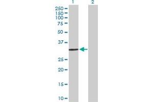 Western Blot analysis of SULT1E1 expression in transfected 293T cell line by SULT1E1 MaxPab polyclonal antibody. (SULT1E1 抗体  (AA 1-294))