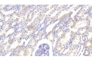 Detection of LEP in Bovine Kidney Tissue using Polyclonal Antibody to Leptin (LEP) (Leptin 抗体  (AA 29-160))