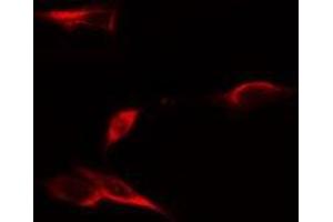 ABIN6275061 staining LOVO cells by IF/ICC. (DPYSL4 抗体  (Internal Region))