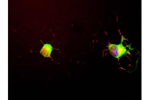 We obtained Neuromics E18 hippocampal neurons and grew them for seven days following the Neuromics protocol. (MAPT 抗体)