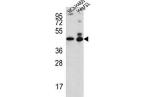 Western Blotting (WB) image for anti-Actin-Like 6B (ACTL6B) antibody (ABIN3002303) (Actin-Like 6B 抗体)