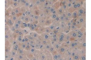 DAB staining on IHC-P; Samples: Mouse Liver Tissue (SGK3 抗体  (AA 141-368))
