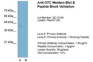 Host:  Rabbit  Target Name:  OTC  Sample Type:  HepG2  Lane A:  Primary Antibody  Lane B:  Primary Antibody + Blocking Peptide  Primary Antibody Concentration:  1. (OTC 抗体  (N-Term))