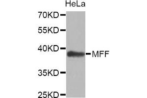 Western blot analysis of extracts of HeLa cell line, using MFF antibody. (MFF 抗体)