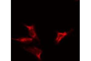 ABIN6275325 staining  HeLa cells by IF/ICC. (NUTF2 抗体  (Internal Region))