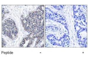 Image no. 1 for anti-Stathmin 1 (STMN1) (Ser37) antibody (ABIN197456) (Stathmin 1 抗体  (Ser37))