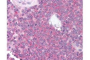 Anti-CD10 antibody IHC of human spleen. (CD101 抗体)