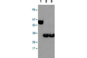 Western blot analysis of Lane 1: Ebi3 recombinant protein Lane 2: mouse bone marrow-derived dendritic cells stimulated with LPS Lane 3: mouse bone marrow-derived dendritic cells stimulated untreated with LPS with Ebi3 monoclonal antibody, clone DNT27 . (EBI3 抗体)