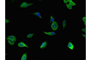Immunofluorescent analysis of Hela cells using ABIN7172291 at dilution of 1:100 and Alexa Fluor 488-congugated AffiniPure Goat Anti-Rabbit IgG(H+L) (TLL1 抗体  (AA 522-643))