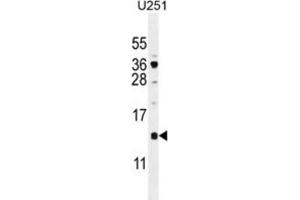 Western Blotting (WB) image for anti-SFT2 Domain Containing 2 (SFT2D2) antibody (ABIN2996054) (SFT2D2 抗体)