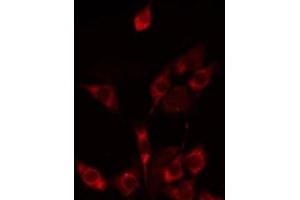 Immunofluorescence (fixed cells) (IF/ICC) image for anti-Solute Carrier Family 25 (Mitochondrial Oxodicarboxylate Carrier), Member 21 (Slc25a21) (Internal Region) antibody (ABIN6259262)