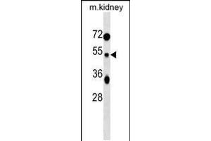 Western blot analysis in mouse kidney tissue lysates (35ug/lane). (TUFT1 抗体  (C-Term))