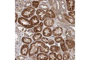 Immunohistochemical staining of human kidney with VPS37A polyclonal antibody  shows strong cytoplasmic positivity in tubular cells. (VPS37A 抗体)