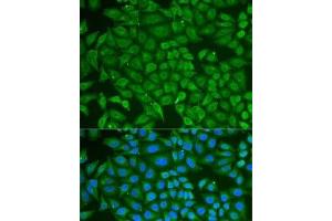 Immunofluorescence analysis of U2OS cells using PIP Polyclonal Antibody (PIP 抗体)
