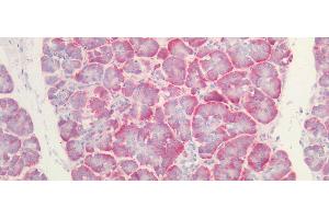 Immunohistochemistry (IHC) image for anti-Fibrinogen-Like 1 (FGL1) (AA 23-312) antibody (ABIN7435316)