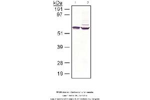 Image no. 1 for anti-Retinal Pigment Epithelium-Specific Protein 65kDa (RPE65) antibody (ABIN363219) (RPE65 抗体)