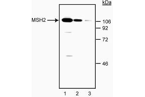 Western blot analysis of MSH-2. (MSH2 抗体)