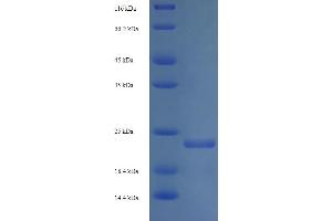 SDS-PAGE (SDS) image for Shiga Toxin Subunit B (StxB) (AA 20-89) protein (His-SUMO Tag) (ABIN5711020) (STXB Protein (AA 20-89) (His-SUMO Tag))