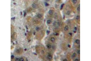 Used in DAB staining on fromalin fixed paraffin-embedded Liver tissue (Fatty Acid Synthase 抗体  (AA 26-78))