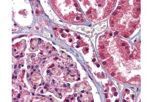 Anti-GFPT1 antibody IHC of human kidney. (GFPT1 抗体  (N-Term))