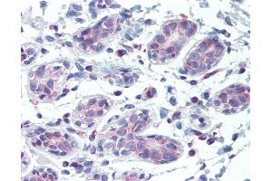 Immunohistochemistry (IHC) image for anti-ATP-Binding Cassette, Sub-Family B (MDR/TAP), Member 5 (ABCB5) (AA 1-30) antibody (ABIN1804042)