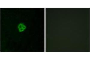 Immunofluorescence analysis of MCF7 cells, using AGTR1 Antibody. (Angiotensin II Type-1 Receptor 抗体  (AA 101-150))