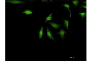 Immunofluorescence of monoclonal antibody to UBE2Z on HeLa cell. (UBE2Z 抗体  (AA 136-225))