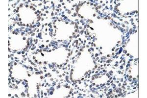 Image no. 1 for anti-Pumilio RNA Binding Family Member 3 (PUM3) (AA 61-110) antibody (ABIN203236) (KIAA0020 抗体  (AA 61-110))