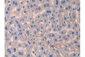 Used in DAB staining on fromalin fixed paraffin- embedded stomach tissue (IL13 Receptor alpha 1 抗体  (AA 28-171))