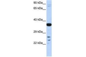 Image no. 1 for anti-Visual System Homeobox 1 (VSX1) (AA 108-157) antibody (ABIN6742618) (VSX1 抗体  (AA 108-157))