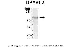 IP Suggested Anti-DPYSL2 Antibody Positive Control: NT2 CELL/BRAIN TISSUE (DPYSL2 抗体  (Middle Region))