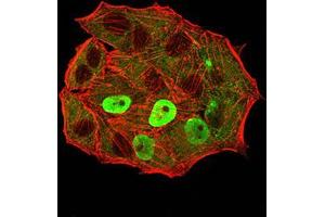 Immunofluorescence (IF) image for anti-Estrogen Receptor 1 (ESR1) (AA 2-185) antibody (ABIN5542593)