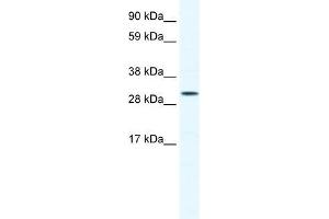 Human Jurkat; WB Suggested Anti-SOX12 Antibody Titration: 0. (SOX12 抗体  (C-Term))