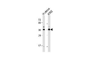 Western Blot at 1:1000 dilution Lane 1: human uterus lysate Lane 2: K562 whole cell lysate Lysates/proteins at 20 ug per lane. (OR52H1 抗体  (C-Term))