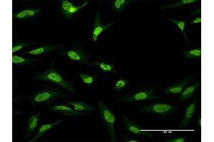 Immunofluorescence of purified MaxPab antibody to CUGBP1 on HeLa cell. (CELF1 抗体  (AA 1-483))