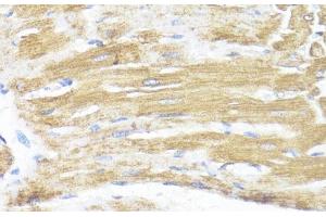 Immunohistochemistry of paraffin-embedded Rat heart using ASMT Polyclonal Antibody at dilution of 1:100 (40x lens). (ASMT 抗体)