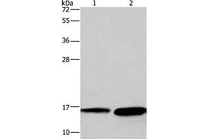 Western Blot analysis of Mouse heart and Human hepatocellular carcinoma tissue using HINT2 Polyclonal Antibody at dilution of 1:300 (HINT2 抗体)