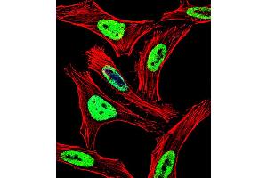 Fluorescent confocal image of Hela cell stained with EWSR1 Antibody . (EWSR1 抗体  (C-Term))