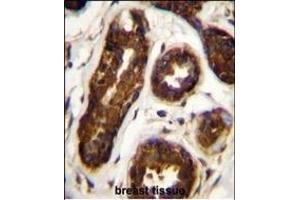 Maspin Antibody (Center) (ABIN656020 and ABIN2845395) immunohistochemistry analysis in formalin fixed and paraffin embedded human breast tissue followed by peroxidase conjugation of the secondary antibody and DAB staining.